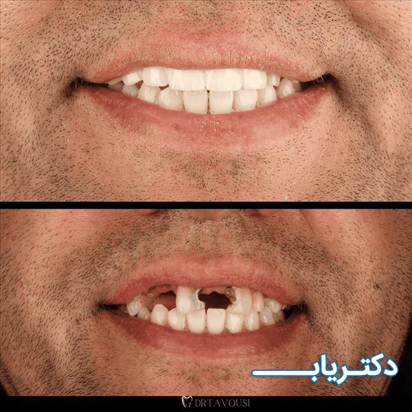 نمونه کار دکتر علی طاوسی