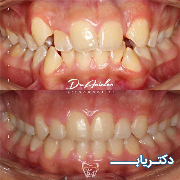 نمونه کار دکتر کوثر عزیزلو 1