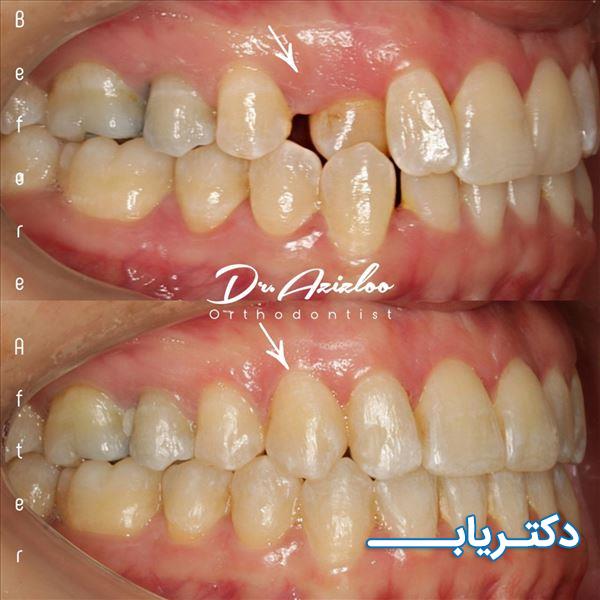نمونه کار دکتر کوثر عزیزلو 3