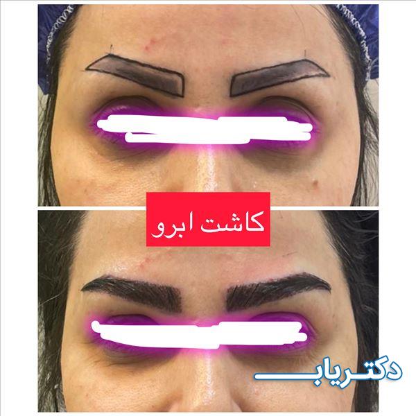 نمونه کار دکتر نسیبه برزکار 3