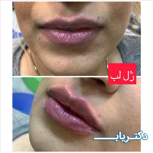 نمونه کار دکتر نسیبه برزکار 4