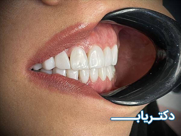 نمونه کار دکتر سعید پورصادقی 4