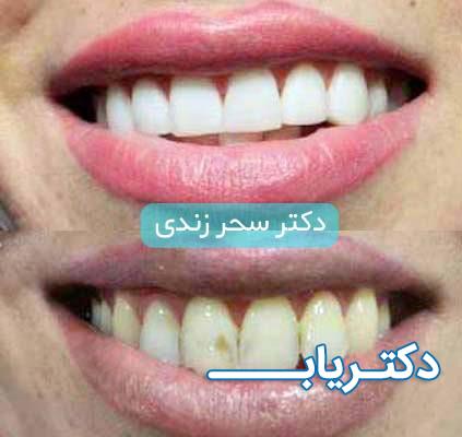 نمونه کار دکتر سحر زندی 1