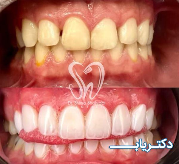 نمونه کار دکتر شیما شهرابی