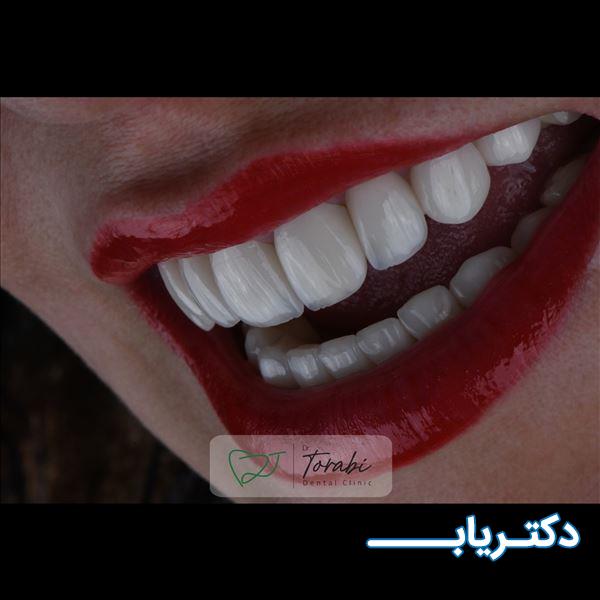 نمونه کار دکتر سیدامیرعلی ترابی 1