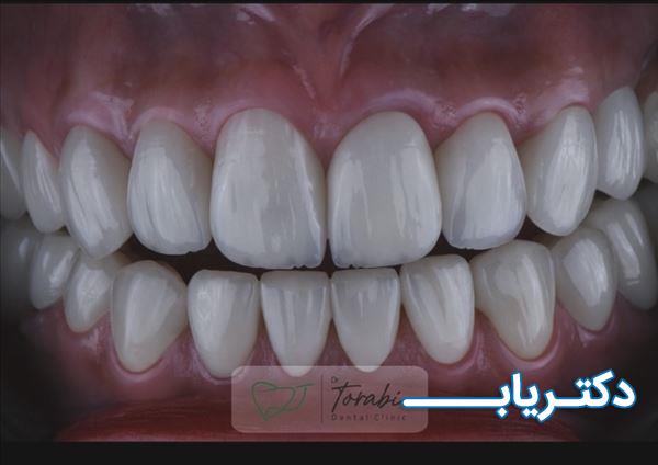 نمونه کار دکتر سیدامیرعلی ترابی 2