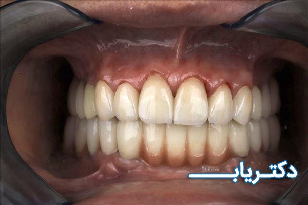 نمونه کار دکتر سیدامیرعلی ترابی 4