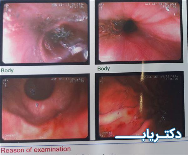 نمونه کار دکتر زینب ولدی