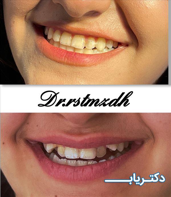 نمونه کار دکتر فاطمه رستم زاده