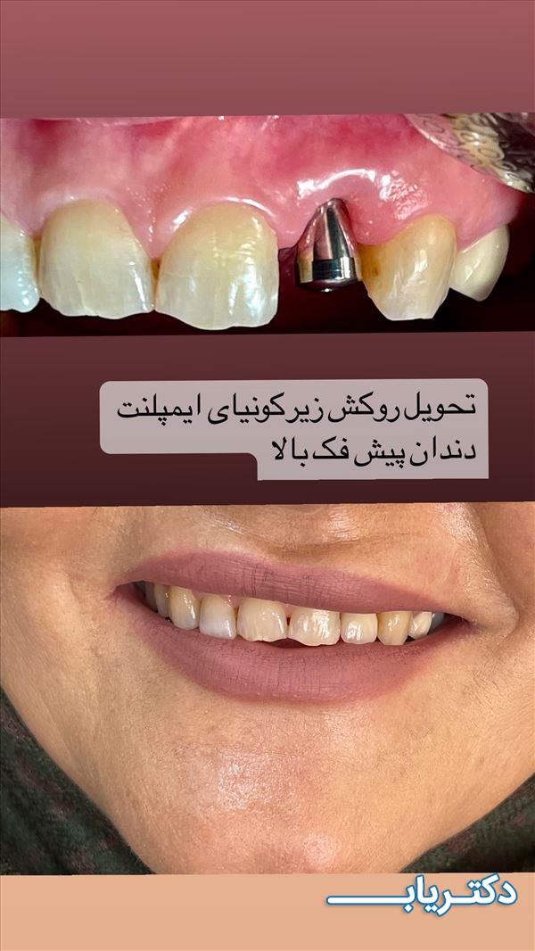 نمونه کار دکتر فاطمه رستم زاده
