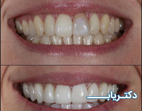 نمونه کار دکتر فائزه گلمکانی 5