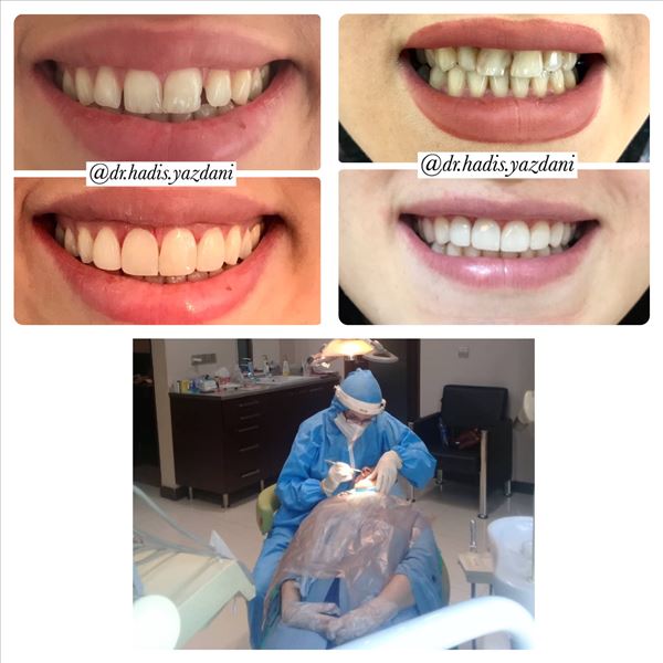 نمونه کار دکتر مرکز دندانپزشکی آرام 2