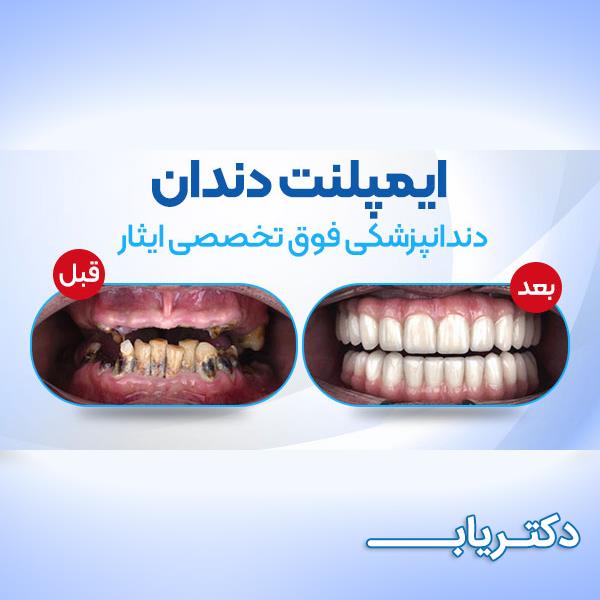 نمونه کار دکتر فاطمه ذوالفقاری 3