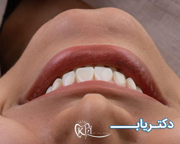 نمونه کار دکتر کیان حقیقی 4