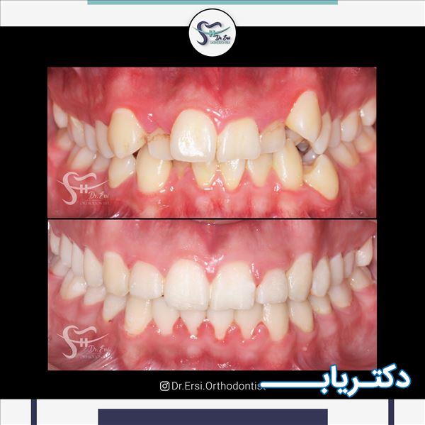 نمونه کار دکتر مهناز ارثی 4