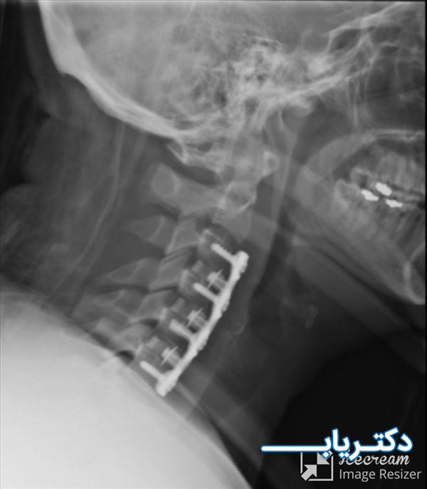 نمونه کار دکتر مهیار آرمان فر