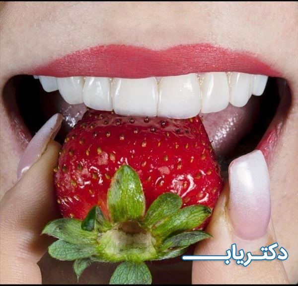 نمونه کار کلینیک دندانپزشکی درسا 5
