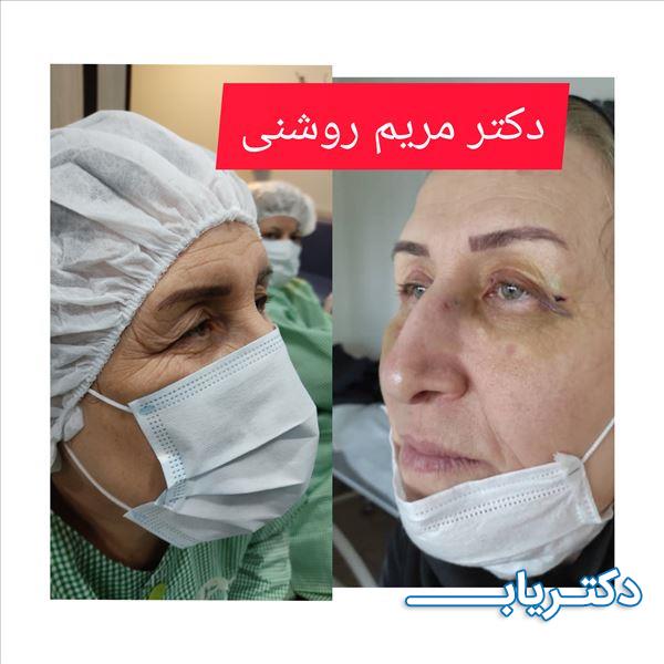 نمونه کار دکتر مریم روشنی 3