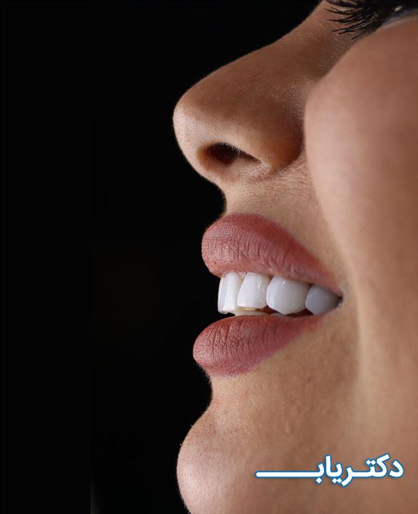 نمونه کار دکتر مجتبی محسنی 2