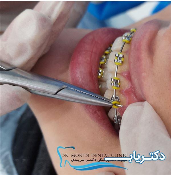 نمونه کار دکتر دانیال مریدی 1