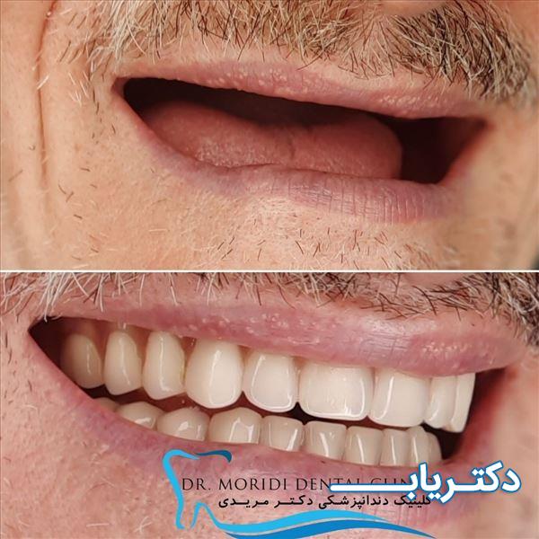 نمونه کار دکتر دانیال مریدی 3