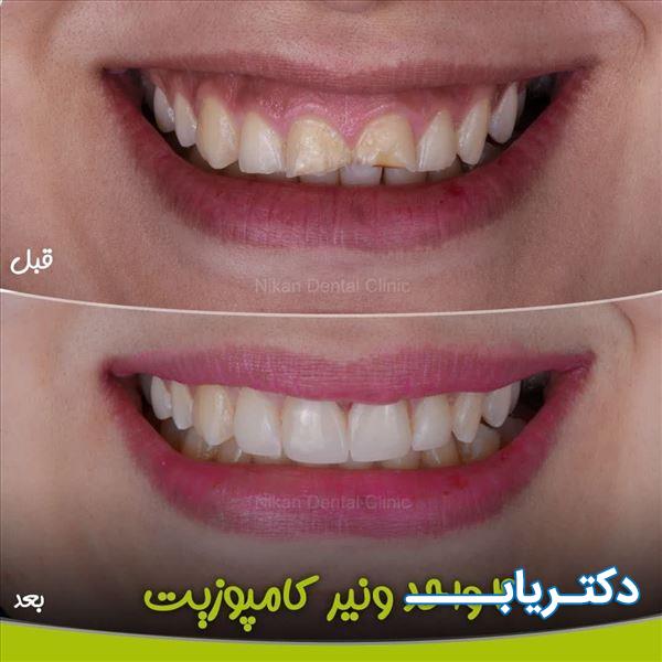 نمونه کار کلینیک دندانپزشکی نیکان اهواز