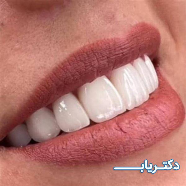 نمونه کار دکتر نیلوفر چرخند