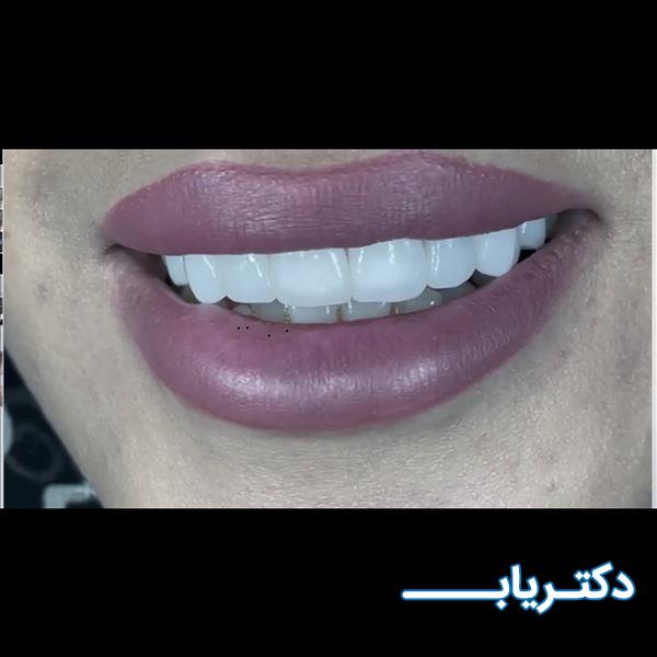 نمونه کار دکتر محسن پوررحمانی 4