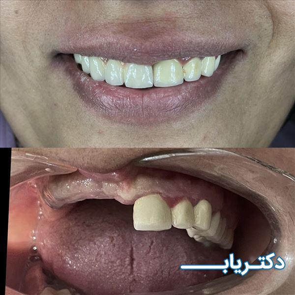 نمونه کار دکتر محسن پوررحمانی 5