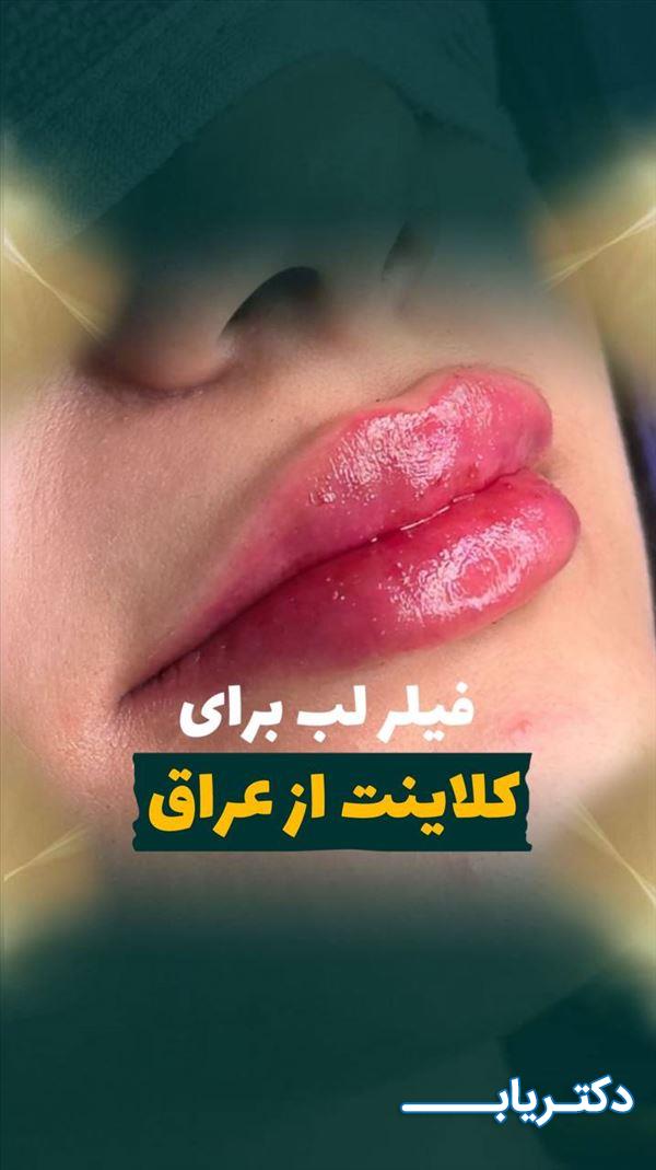 نمونه کار دکتر محمدرضا محبی فر