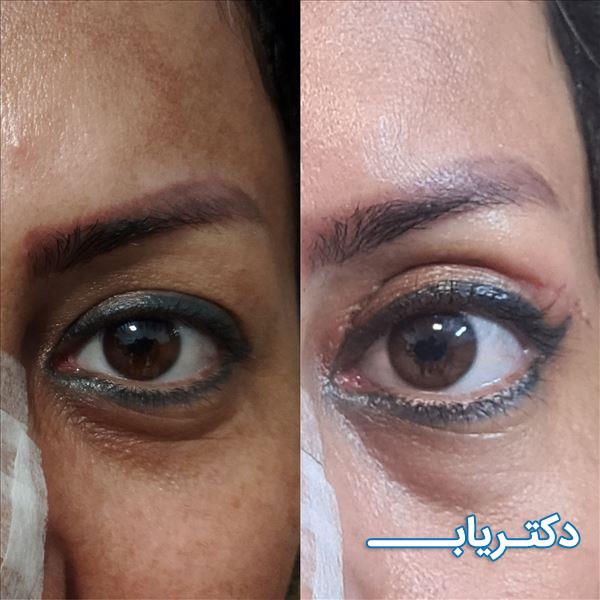 نمونه کار دکتر رضا پورمحمدی 1