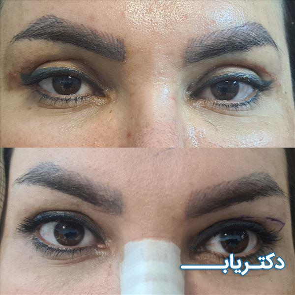 نمونه کار دکتر رضا پورمحمدی 2