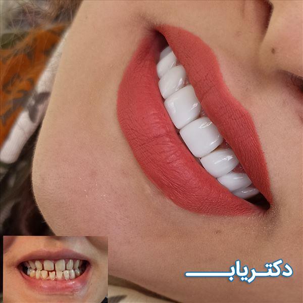 نمونه کار دکتر سارا اجودی 4