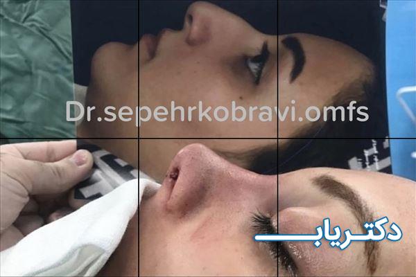 نمونه کار دکتر سپهر کبروی 1