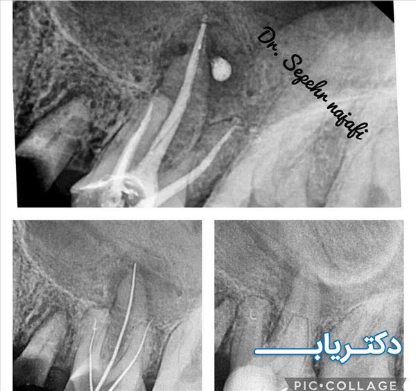 نمونه کار دکتر سپهر نجفی قدسی