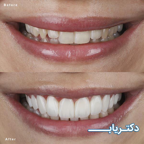 نمونه کار دکتر رضا خسروانی