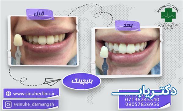 نمونه کار کلینیک دندانپزشکی سینوهه 3
