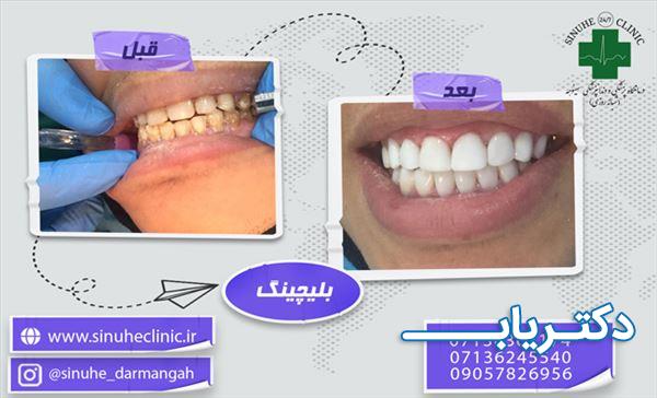 نمونه کار کلینیک دندانپزشکی سینوهه 5