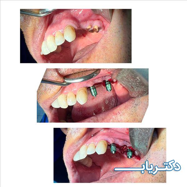 نمونه کار دکتر طیبه قاسمی 1