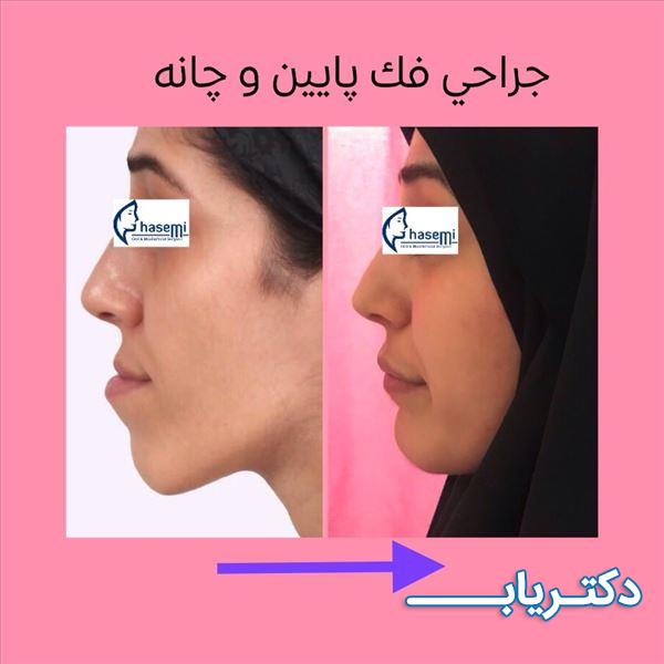 نمونه کار دکتر طیبه قاسمی 2
