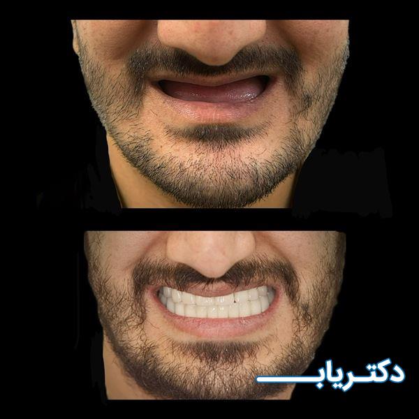 نمونه کار دکتر طیبه قاسمی 3