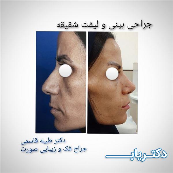 نمونه کار دکتر طیبه قاسمی 4