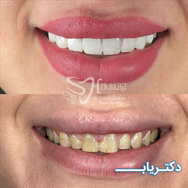 نمونه کار دکتر زکریا شیربیگی