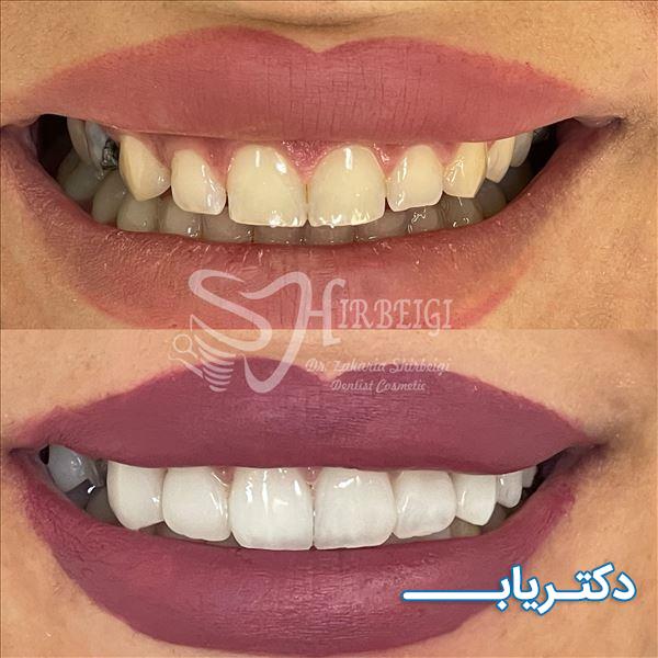 نمونه کار دکتر زکریا شیربیگی